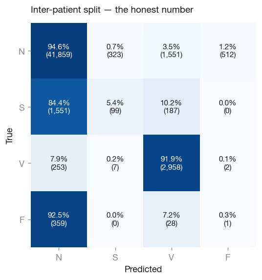 Confusion matrix, inter-patient split.